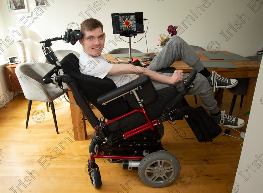 dan-eye-1 
 Cillian McSweeney at his home in Wlton, Cork who penned a song for frontline workers using eye gaze computer technology. Picture Dan Linehan